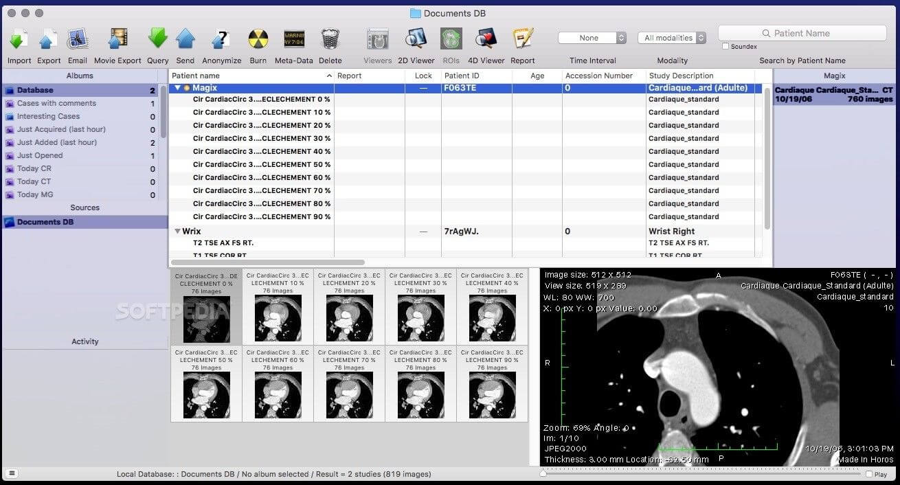 Horos - Created by PostDICOM